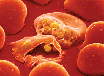 Image: Malaria parasites infect two blood cells (Photo courtesy of Lennart Nilsson).